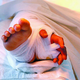Image for article titled Doctors Save Girl's Hand By Grafting It To Her Leg For 3 Months